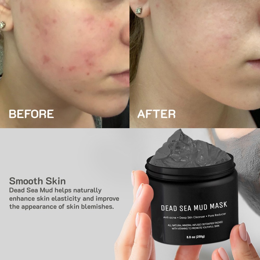 Dead Sea Mud Mask: image 10