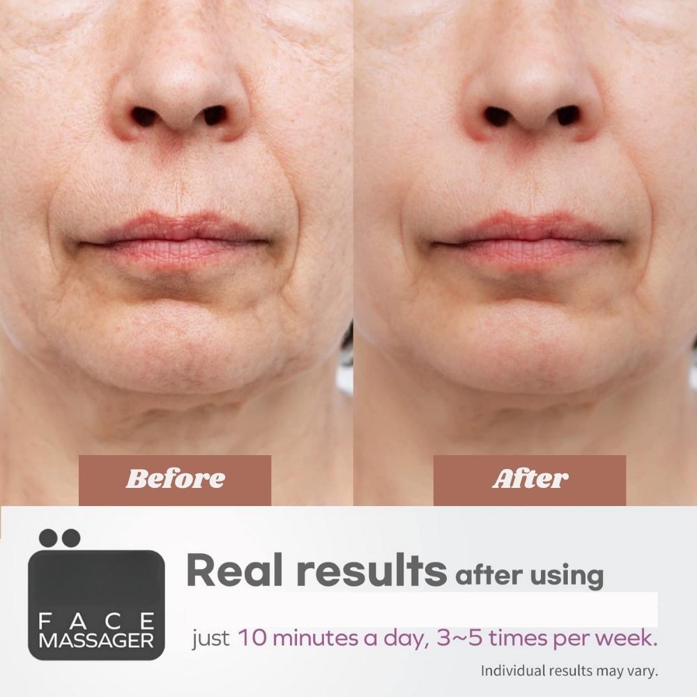 Facial Massager Device: image 6